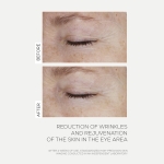 INFUSÍON LIFT Supreme - Lift Firming Serum INFUSÍON LIFT Supreme - Lift Firming Serum